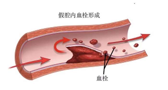 真心建议：别再随便按脖子了