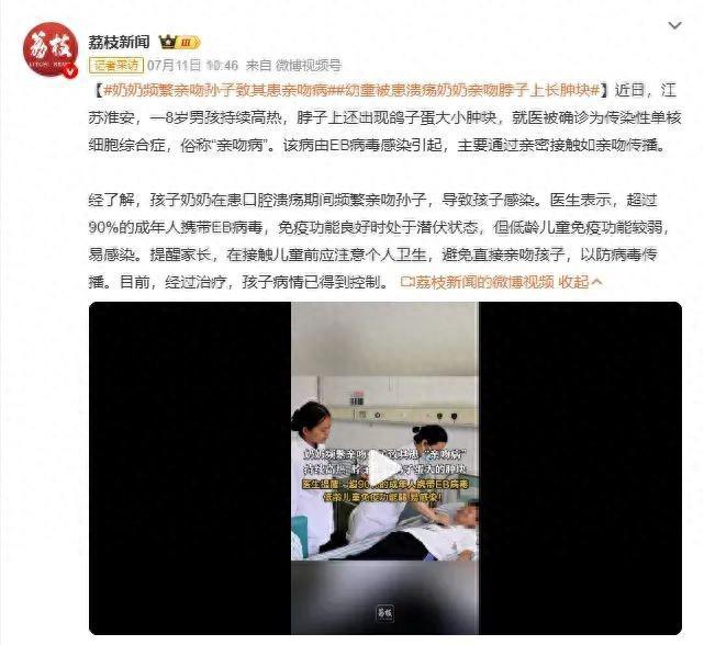 别亲孩子脸颊了！小心这种病！