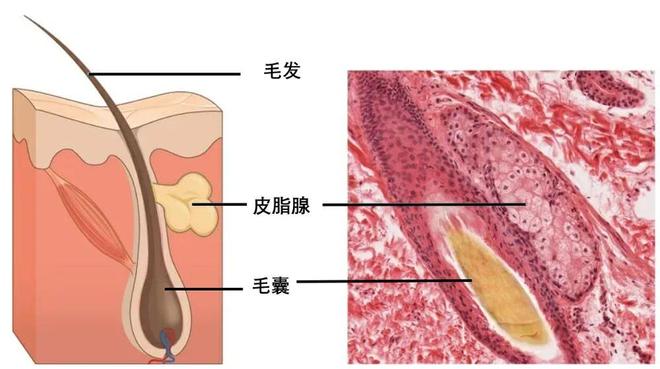 下巴凸起的小颗粒，到底是什么？