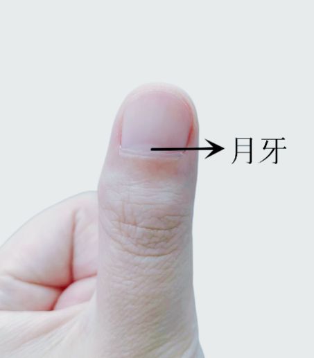 紧急提醒：指甲出现这种变化，可能是癌变信号！