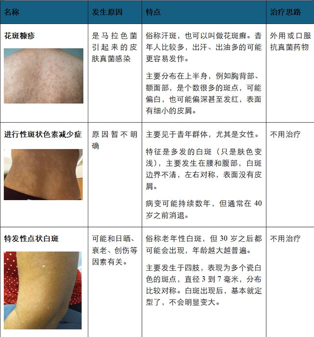 突然白了一块，是得了白癜风吗？