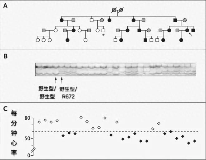 一觉醒来心率40，是猝死前兆还是身体在报警？
