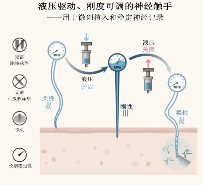 脑机接口新突破！仿章鱼触手“神经探针”微创植入引热议