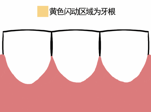 牙龈萎缩能逆转吗？真相揭秘