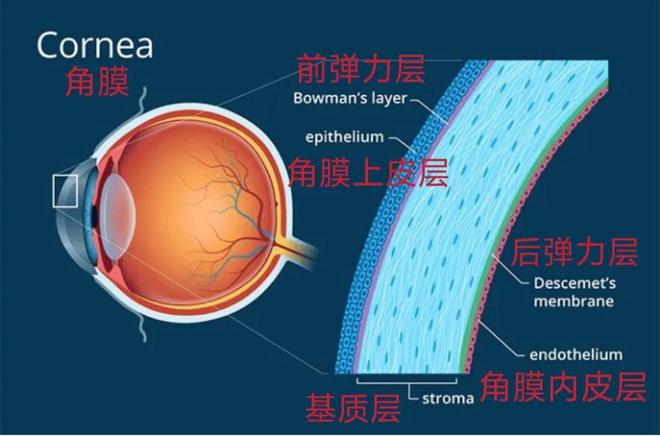 近视激光手术后，他们后悔了吗？