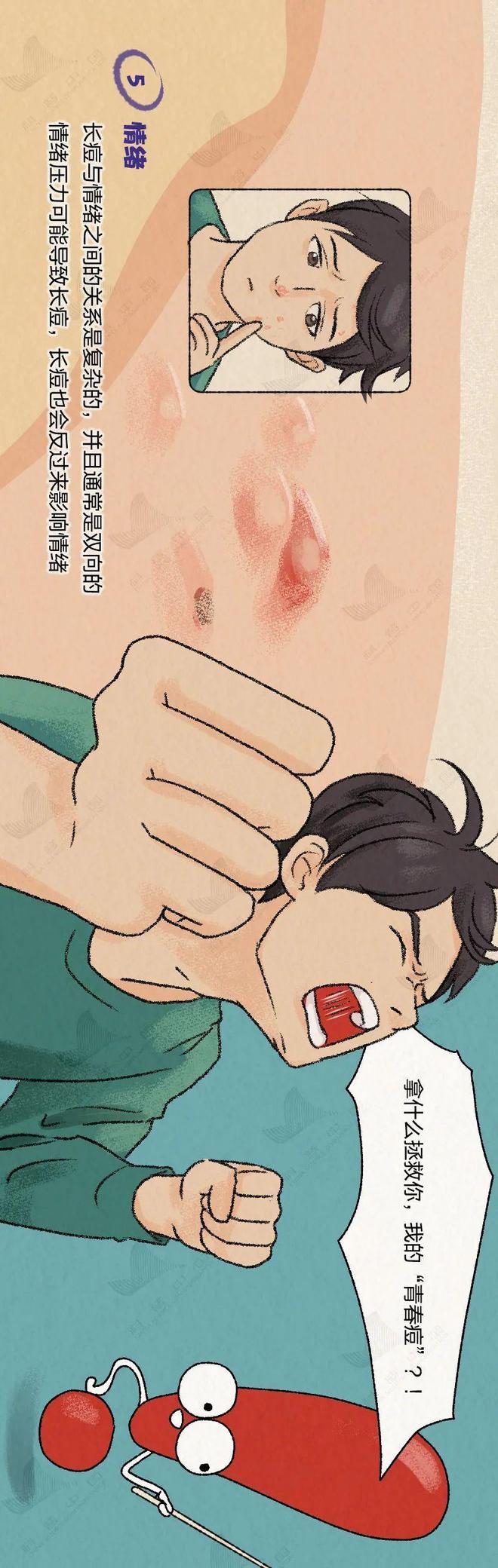 你脸上的痘痘就是这样一步步长出来的！全过程曝光