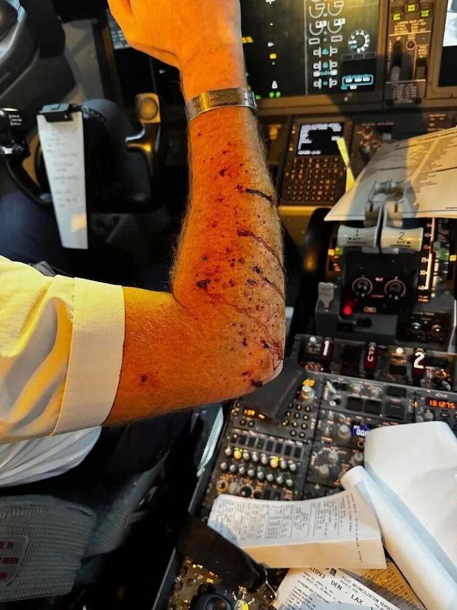 美客机万米高空风挡破裂飞行员受伤